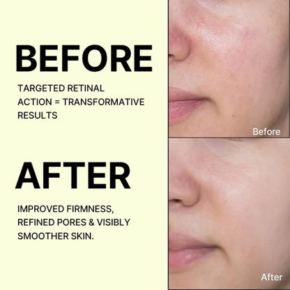 Celimax The Vita-A Retinal Shot Tightening Booster (15ml)