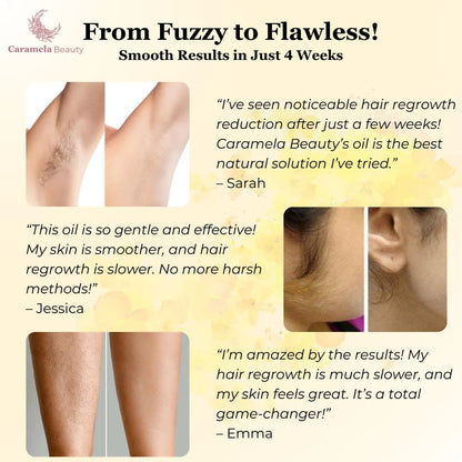 Caramela Beauty Cyperus Rotundus Oil